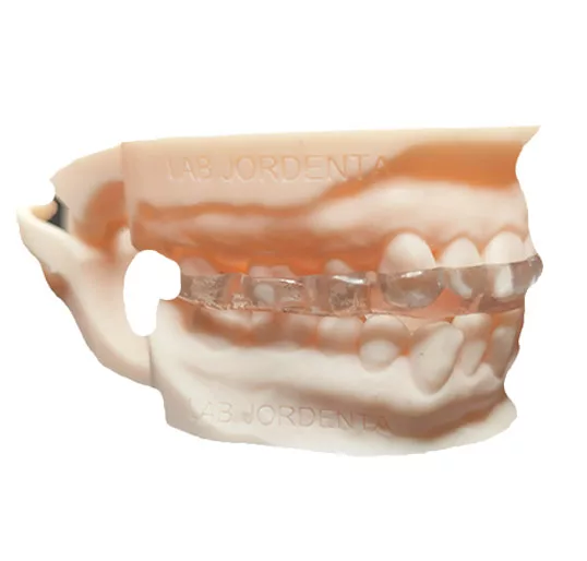 laboratorio dental en ferulas-3d