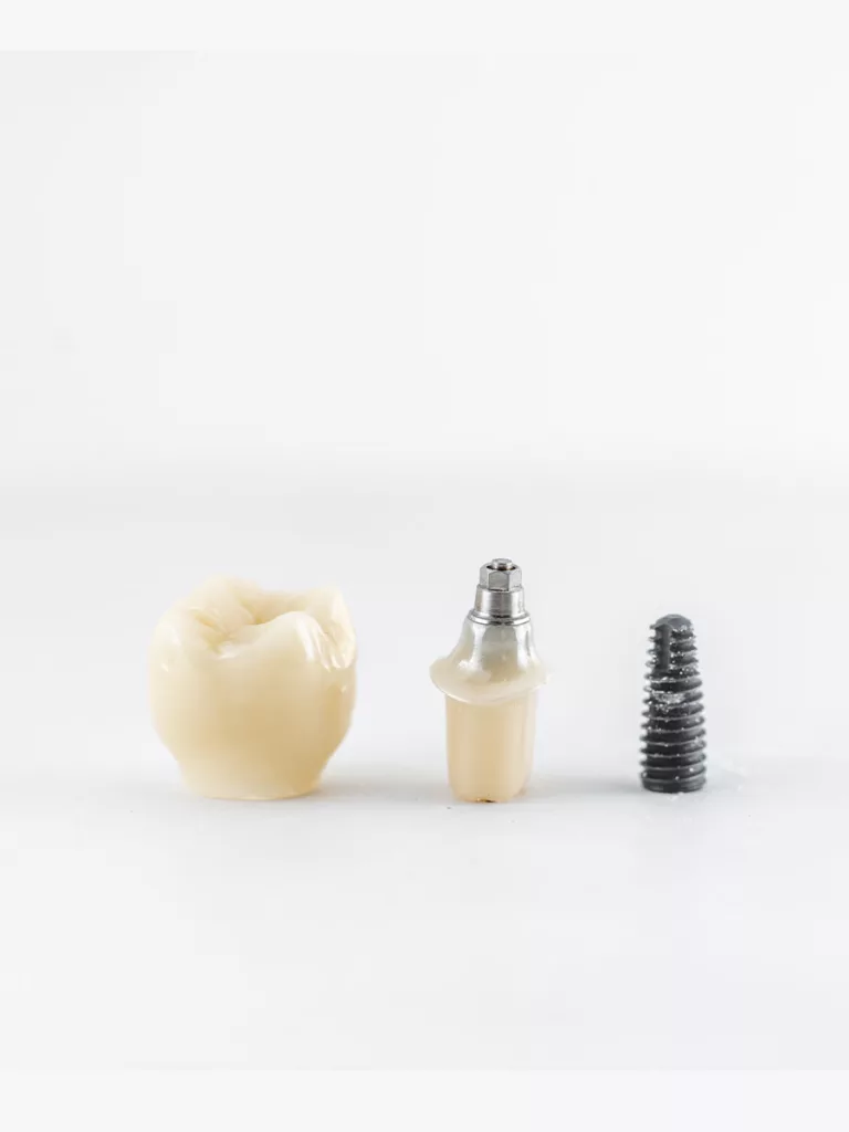 implante-dental-en-laboratorio-protesico-barcelona