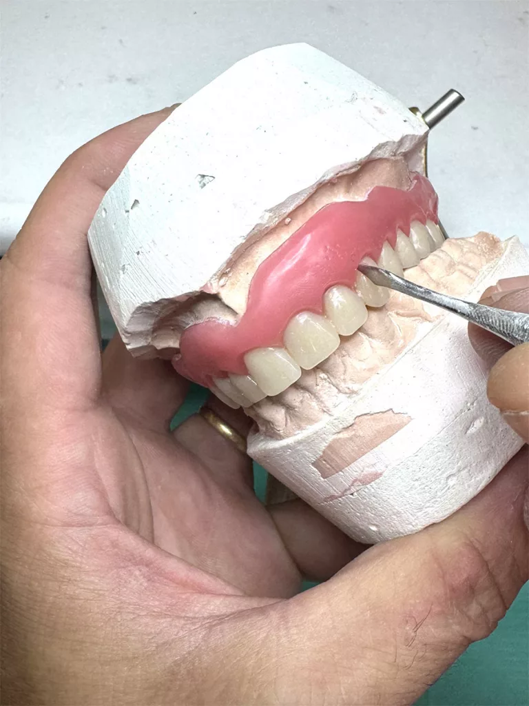 laboratorio-dental-barcelona-protessi-removible