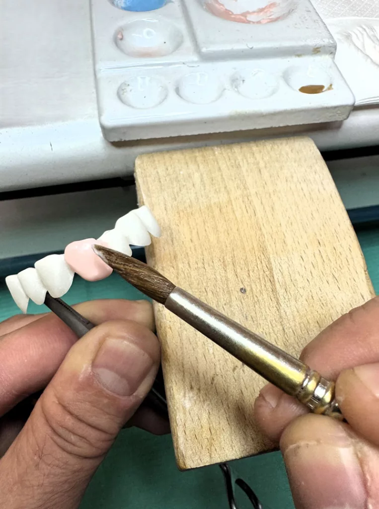 laboratorio-dental-proteicobarcelona-protesis-fija-4
