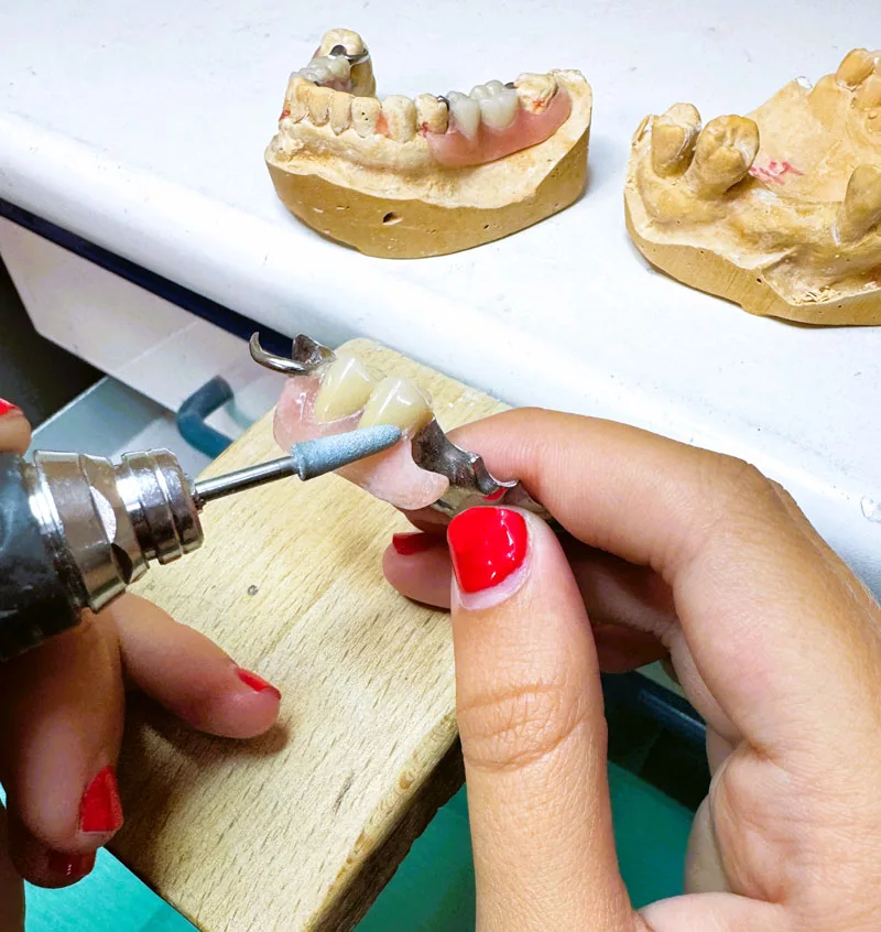 laboratorio-dental-protesico-fabricante-en-barcelona-de-protesis-semiflexible