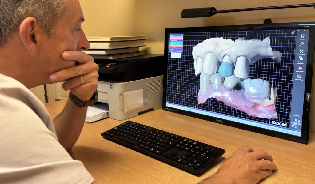 laboratior-dental-barcelona-fabricante-de-protesis-fijas-dentales